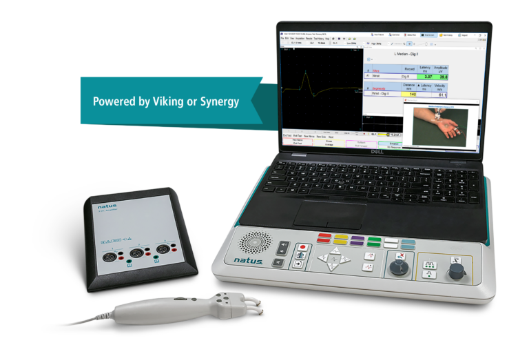 EMG/EEG diagnostická obrazovka